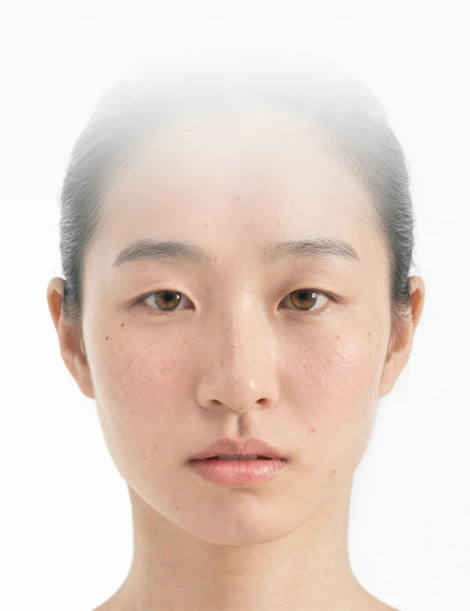 엑소좀 서브시전